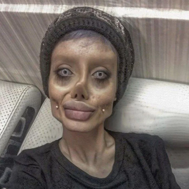 Zombi Angelina hiç estetik ameliyatı yaptırmadığını söyledi
