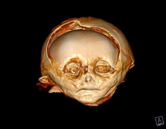 400 yıl önce ölen mumyalanmış: Gizemi çözüldü
