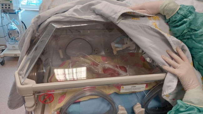 Türkiye’nin en küçük bebeklerinden: Sadece 310 gram