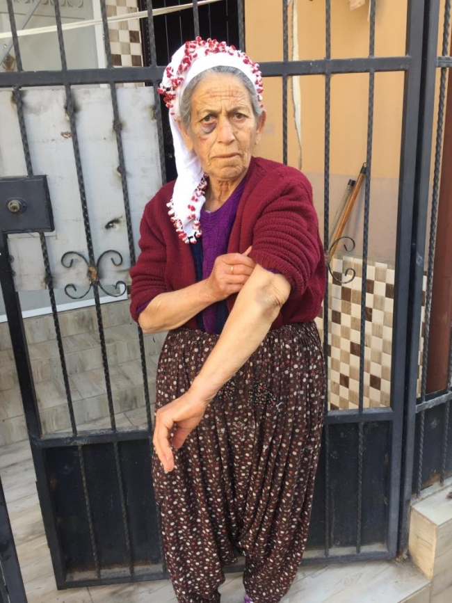 Kanser hastası yaşlı kadını bayıltana kadar dövüp, gasp etti