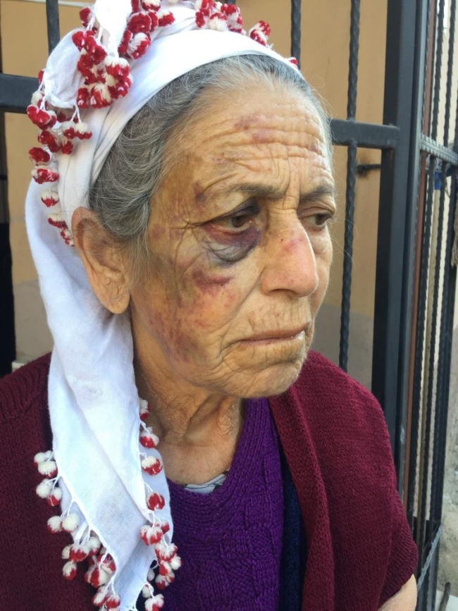 Kanser hastası yaşlı kadını bayıltana kadar dövüp, gasp etti