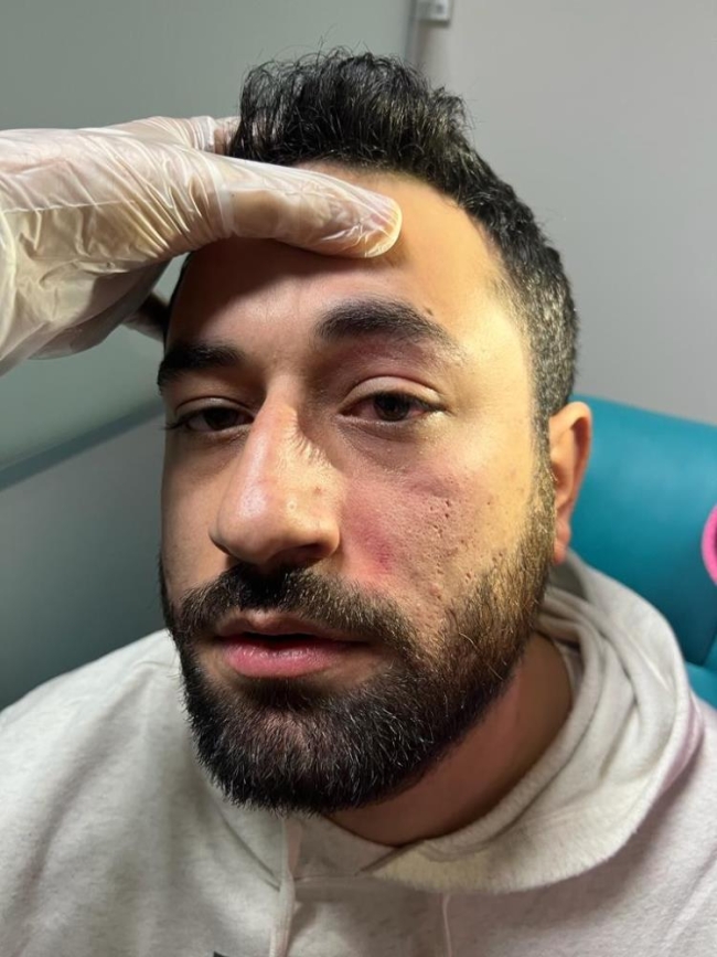 Doktoru darp eden şahıs serbest bırakıldı