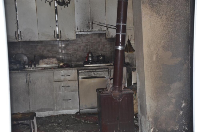Yangından 20 gün sonra yaşam mücadelesini kaybetti