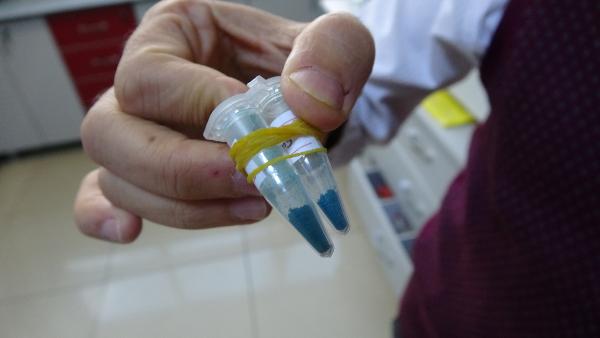 Türk bilim insanlarından çığır açacak buluş: 4 kanser türü ile savaşacak