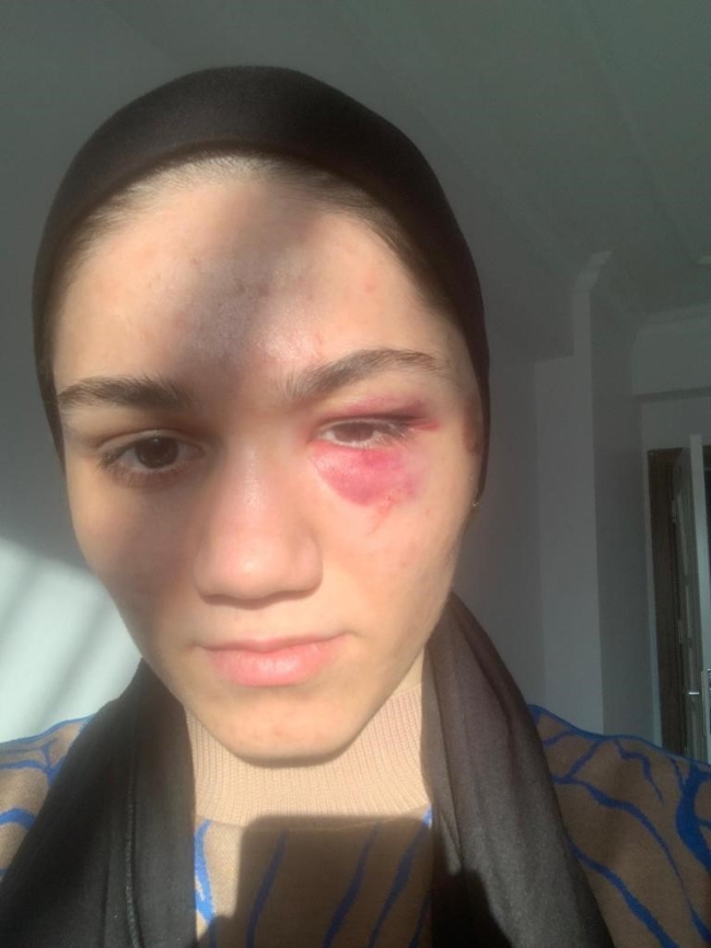 Depremden kaçıp sığındıkları köy kabusları oldu
