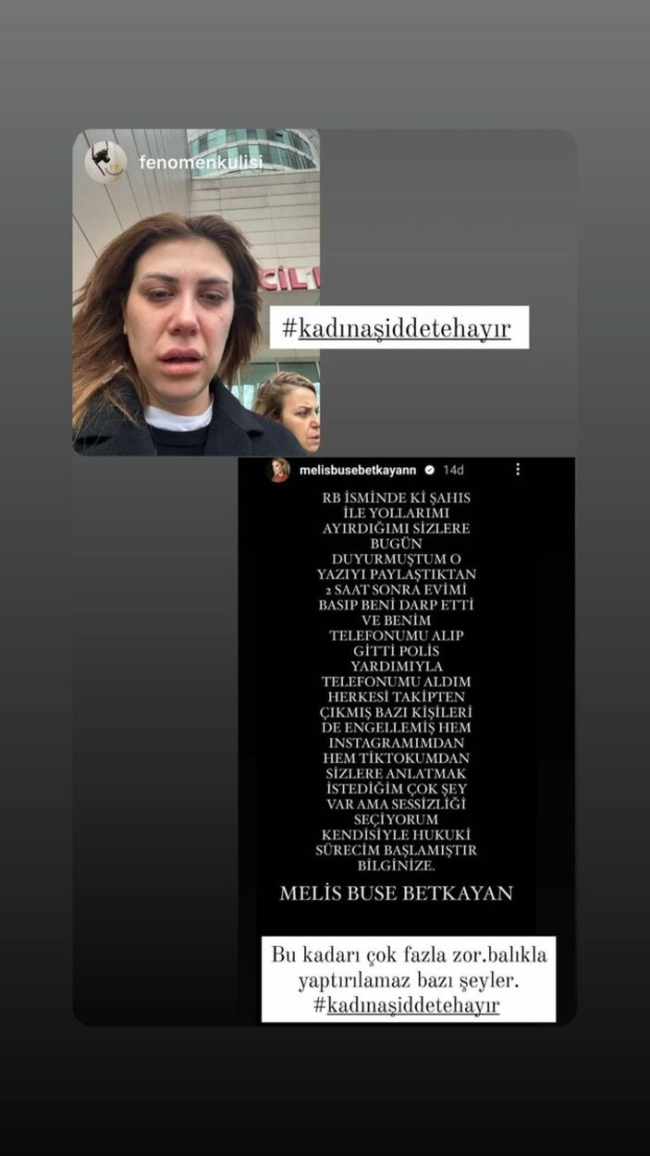 Sevgilisinin şiddetine uğradı: 'Evimi bastı, darp etti'
