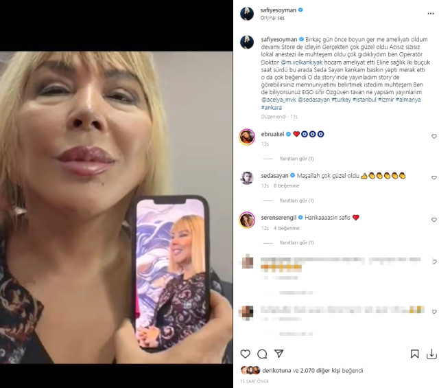 Seda Sayan'ın baskısıyla ameliyat oldu