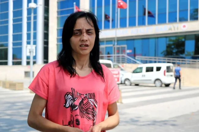 Tanımadığı kadını yumrukladı! İşte istenen ceza