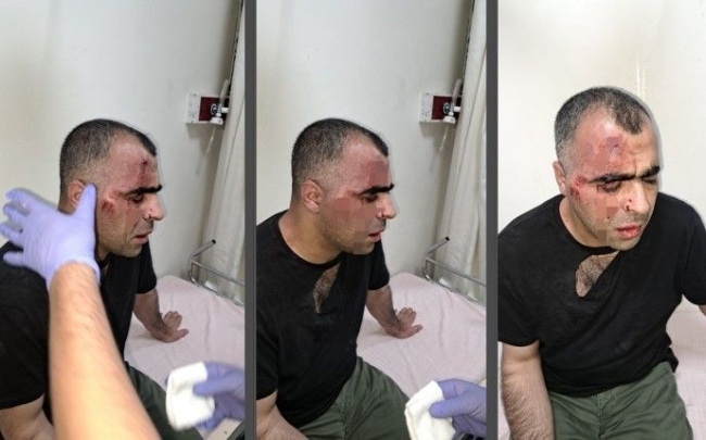 Belediye çalışanı gazeteciyi darp etti!