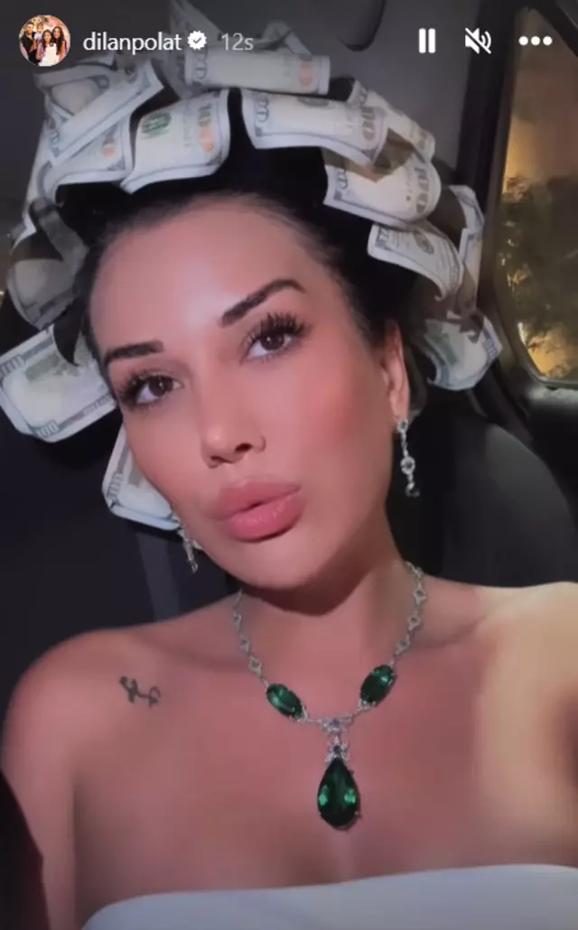 Saçına dolar takıp gezdi! Sosyal medyanın diline düştü