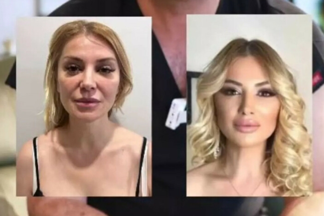 Songül Karlı estetik yaptırmaya devam ediyor!