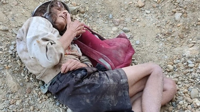 Uçurumdan düşen Fransız kadın hastaneye kaldırıldı
