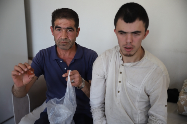Yediği sucuktan demir çıktı