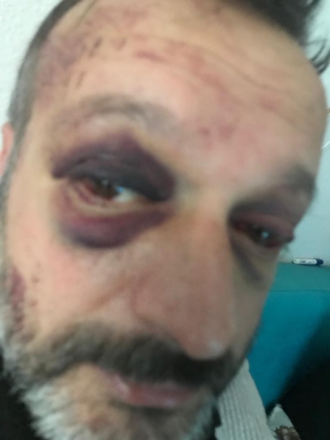 Bursa'da çiftetelli dayağında hapis cezası çıktı