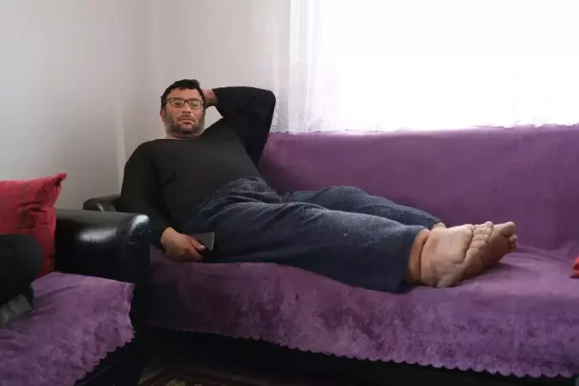 Bacakları her yıl 7 santim büyüyor!