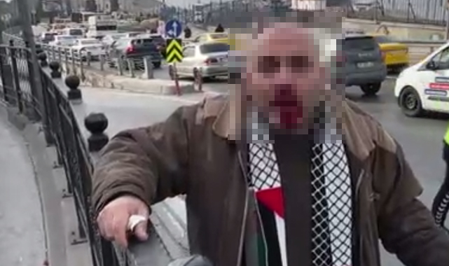 Galata Köprüsü'ndeki yürüyüşten dönen vatandaş saldırıya uğradı