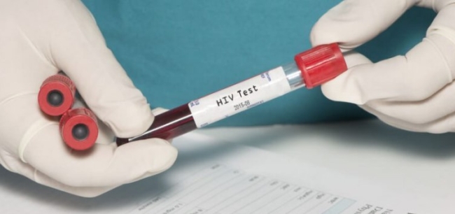 AIDS'te yeni tedavi umudu