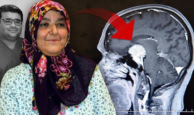 Bir türlü teşhis konulamamıştı: Burnundan çıkarıldı
