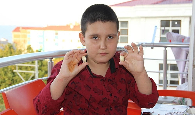 Sarımsak yemeden duramıyor