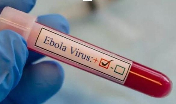 Uganda’daki Ebola salgınında can kaybı yükseliyor