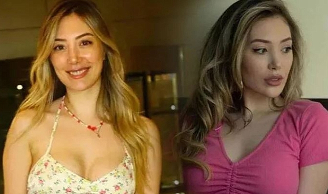 Yasmin Erbil'den 'estetik' itirafı