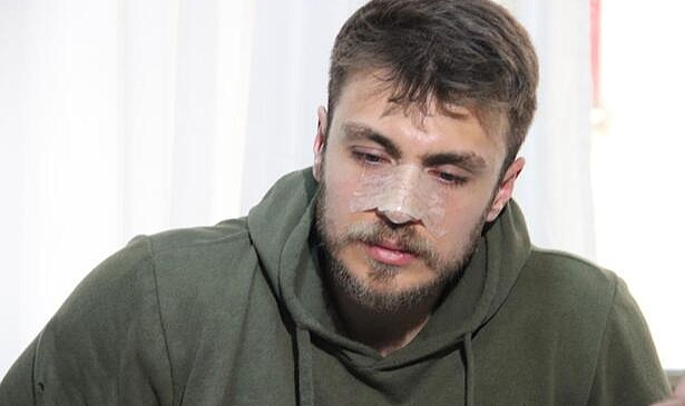 İzmir'de asistan doktorun burnu kırıldı
