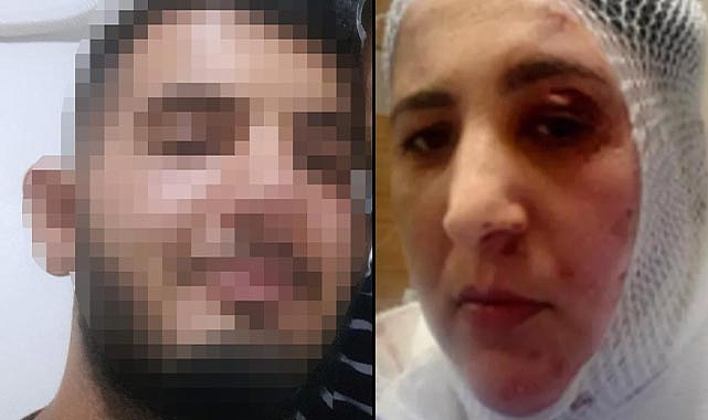 Üvey annesine kezzapla saldıran genç tutuklandı