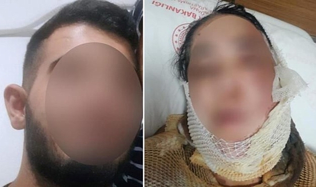 Üvey anneye kezzaplı saldırı