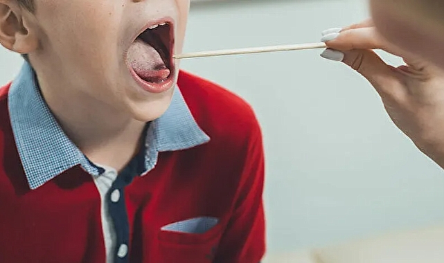 5 soru 5 cevap: Strep A nedir?