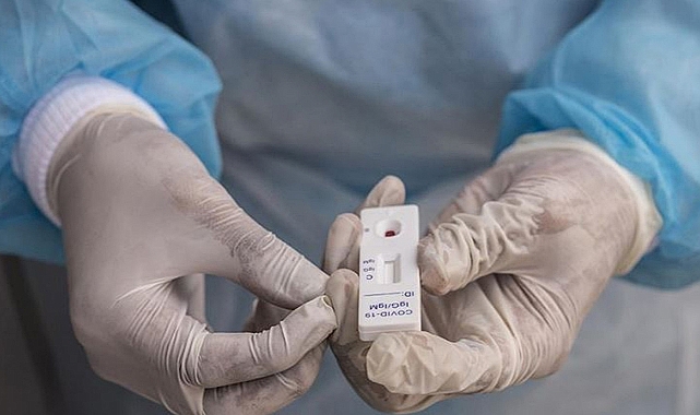 Hollanda'dan ücretsiz test kararı