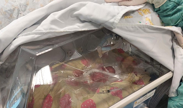 Türkiye’nin en küçük bebeklerinden: Sadece 310 gram