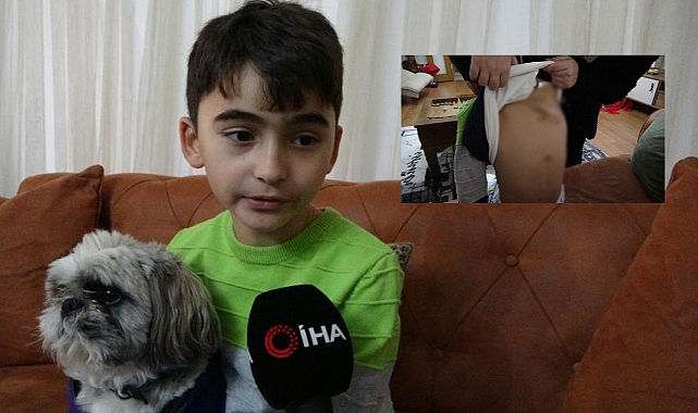 10 yaşındaki çocuğa, köpekler saldırdı