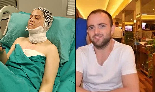 Eski eşinin yüzüne kimyasal madde attı