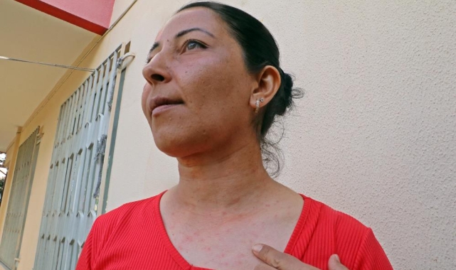 Evinin bahçesindeki tırtılları süpüren kadın hastanelik oldu
