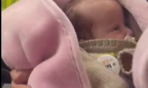 5 aylık bebeği kafası yarık halde gezdirdiler