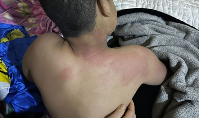 Bursa'da çocuğu kaynar çayla yaktı, tutuklandı