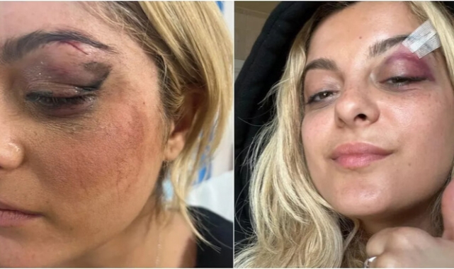 Bebe Rexha’ya telefon fırlatıldı