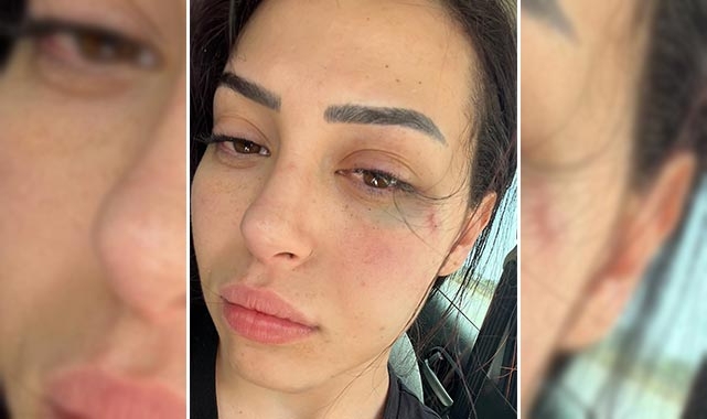 GKRY’da saldırıya uğrayan Karaali’nin duruşması 6 Temmuz’da yapılacak