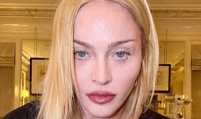 Madonna: Hayatta olduğum için şanslıyım