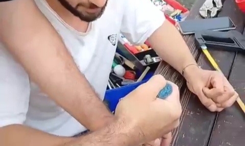 Parmağına sıkışan yüzük spiral makinesi ile kesilerek çıkarıldı