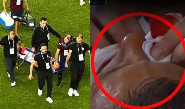 Trabzonspor'a sakatlık şoku