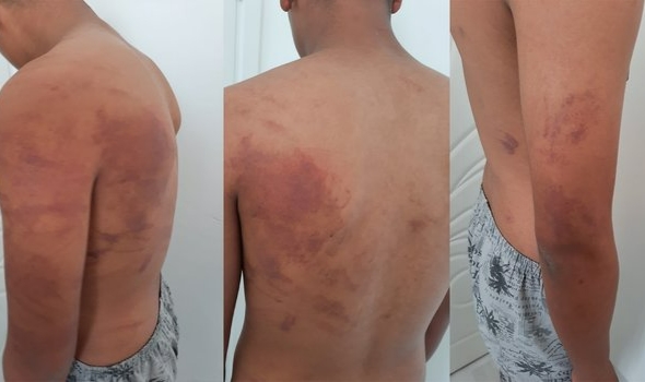 15 yaşındaki çocuğa babası ve amcasından zincirli işkence!