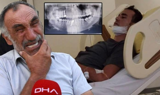Muayeneye çağırdılar çenesini kırdılar