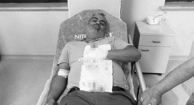Şanlıurfa'da yorgun mermi ile yaralandı!