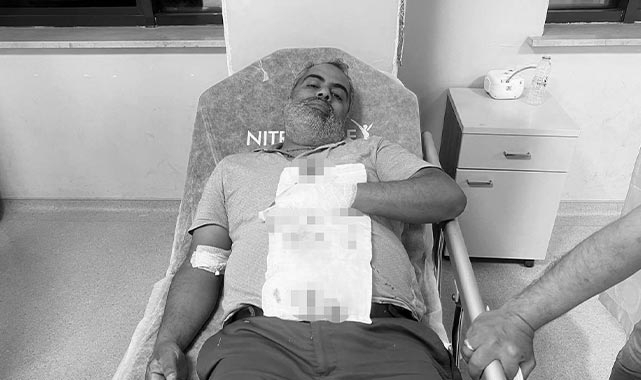 Şanlıurfa'da yorgun mermi ile yaralandı!