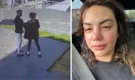 Ece Ronay'a eski eşinden şiddet