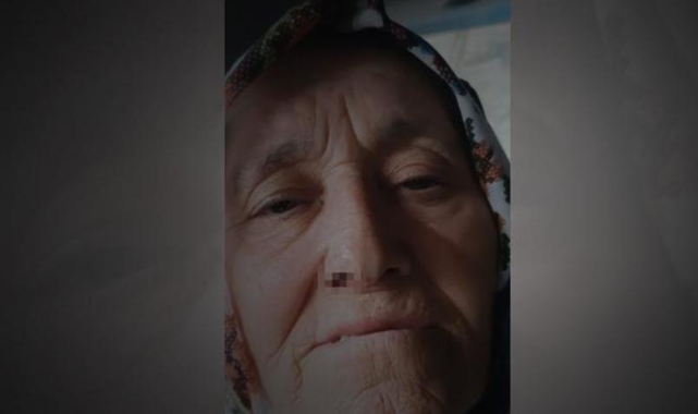 Fındık tartışmasında 73 yaşındaki kadını darbettiler