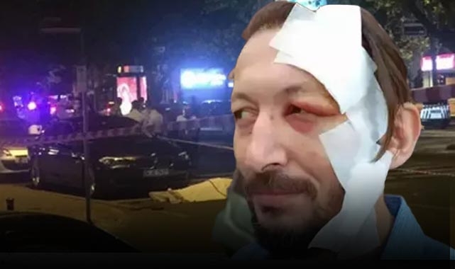 İstanbul'da akılalmaz olay! Kavgayı izlediği için bıçaklandı