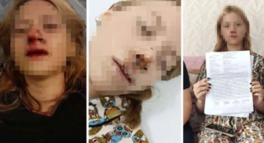 Genç kızın suratına taş atıp dişlerini kırmıştı! Tahliye edildi