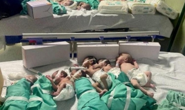 Solunum cihazları durdu! Gazze'de sözün bittiği yer